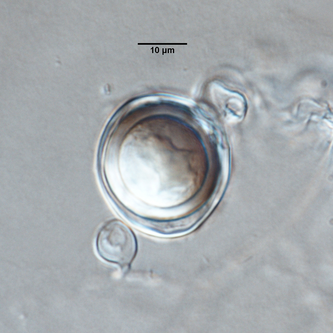   Phytophthora quercetorumnbsp; (ex-type CPHST BL 52G) sexual phase: smooth-walled oogonium withnbsp;paragynous antheridiumnbsp;and aplerotic oospore; photo by Gloria Abad, USDA-APHIS-PPQ. 
